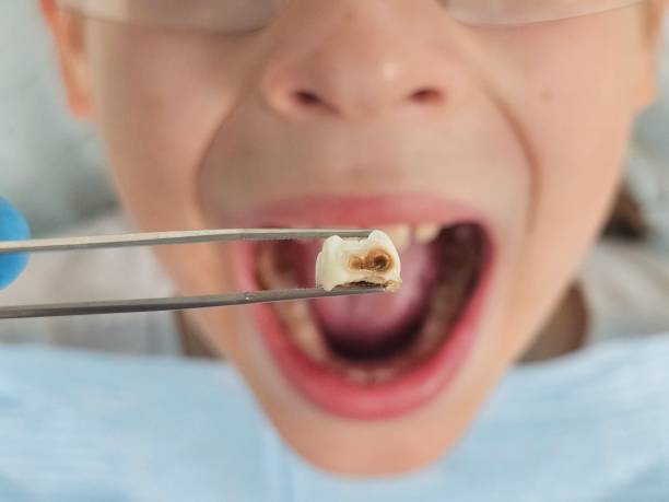 Best Emergency Pediatric Dentist  in Rosemont, IL
