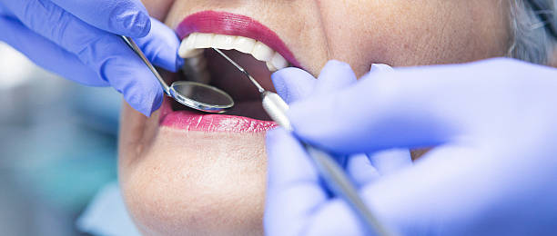 Best Knocked-Out Tooth Emergency  in Rosemont, IL